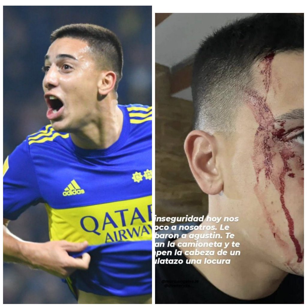 AGGREDITO GIOCATORE BOCA