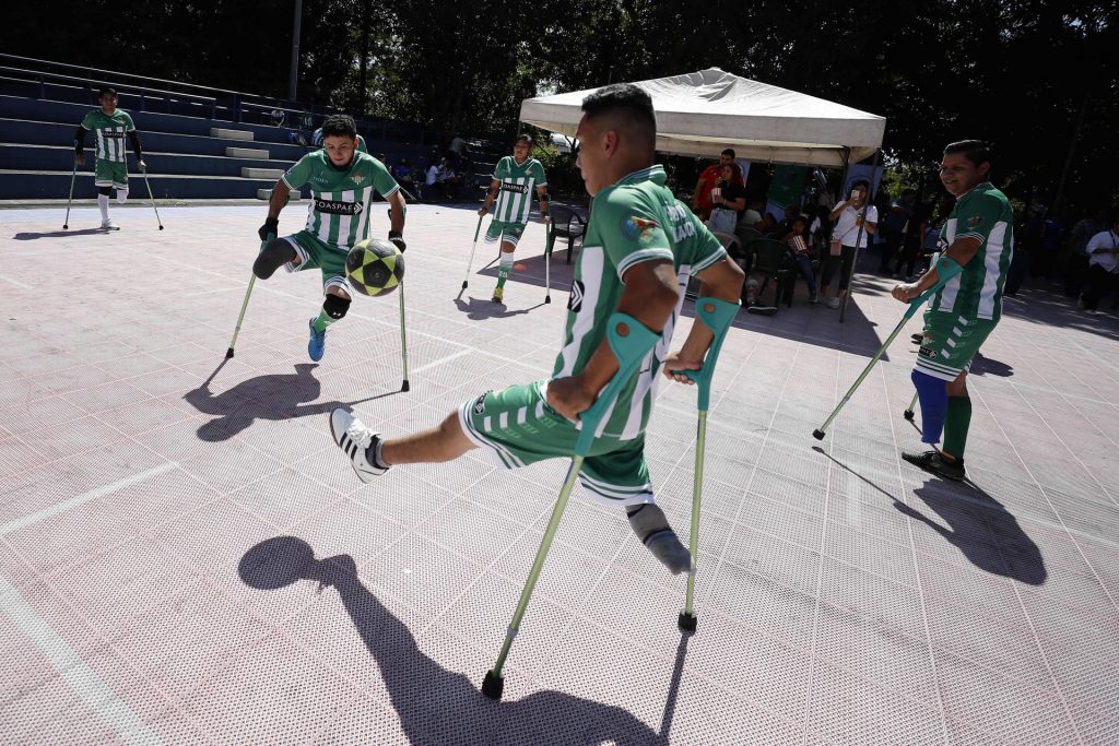 Joven de 17 años recibe beca de Real Betis para jugar fútbol de amputados