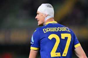 Hellas Verona v Bologna FC - Serie A