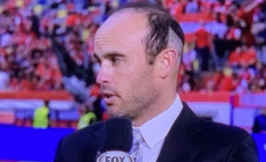Landon Donovan dopo il trapianto di capelli