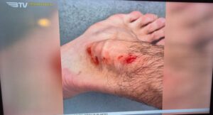 infortunio antonio silva